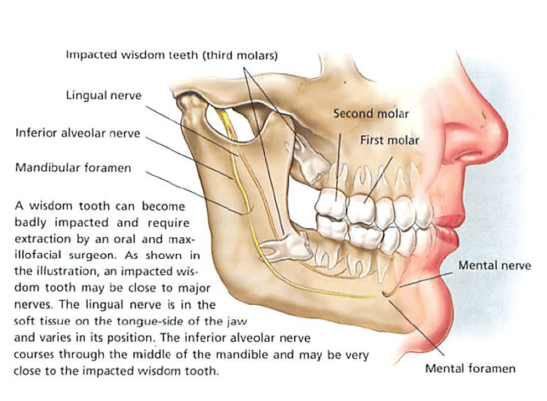 Wisdom Tooth Removal North Shore Oral Maxillofacial Surgery